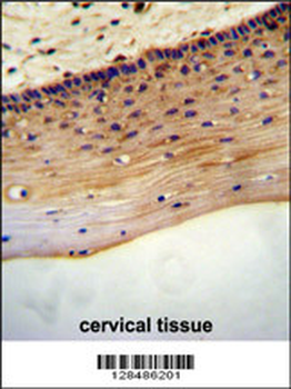LRC18 Antibody (C-term)
