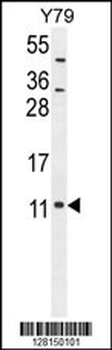 NDUAB Antibody (Center)
