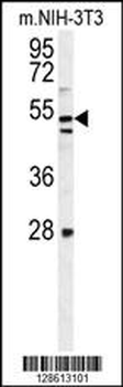 KIAA1609 Antibody (C-term)