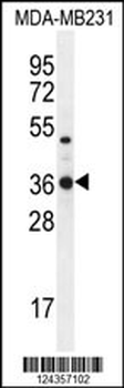 TPSD1 Antibody (C-term)