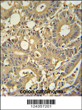 TPSD1 Antibody (C-term)