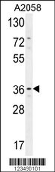 GRINA Antibody (Center)