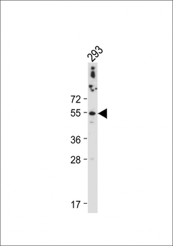 CTSA Antibody (N-term)