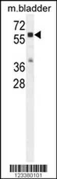 CTSA Antibody (N-term)