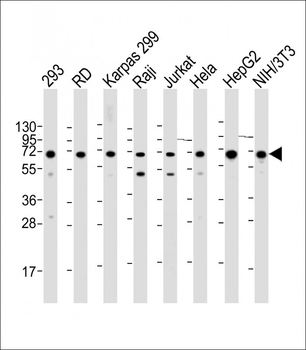 IGF2BP1 Antibody (C-term)