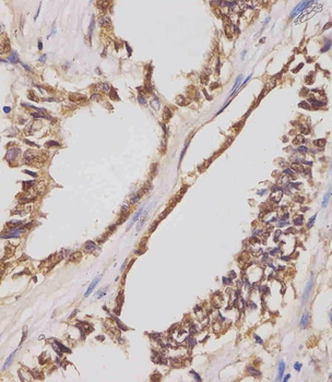 IGF2BP1 Antibody (C-term)