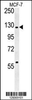 RABGAP1 Antibody (N-term)