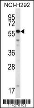 SMYD2 Antibody (N-term)