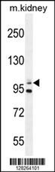 Nephrin (Y1210) antibody