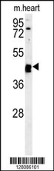 TINAGL1 Antibody (C-term)