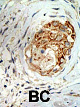 MBD3 Antibody (C-term)