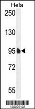 EFTUD1 Antibody (C-term)