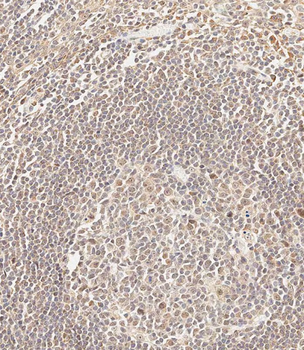 CEPT1 Antibody (N-term)