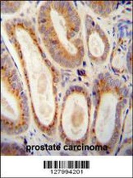 WFDC12 Antibody (C-term)