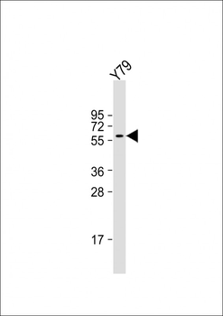 SLC5A12 Antibody (C-term)