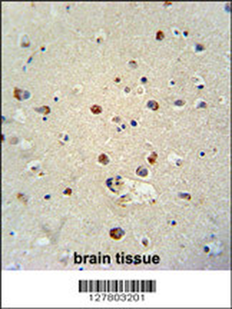 RILPL1 Antibody (C-term)