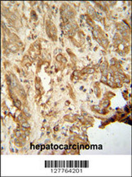 NAT14 Antibody (N-term)