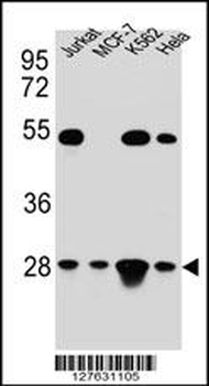 TFAM Antibody (C-term)