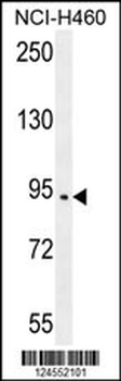 SPARCL1 Antibody (Center)