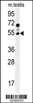 GABRG2 Antibody (Center)