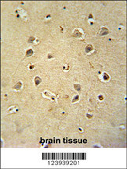 GABRG2 Antibody (Center)