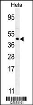 FOXL2 Antibody (N-term)
