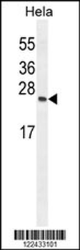 TIMP4 Antibody (Center)