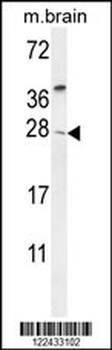 TIMP4 Antibody (Center)