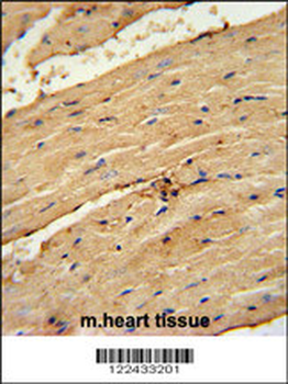 TIMP4 Antibody (Center)