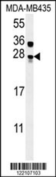 MUTED Antibody (Center)