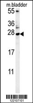 MUTED Antibody (Center)