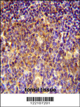 MUTED Antibody (Center)