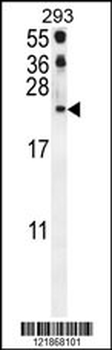 CCL21 Antibody (Center)