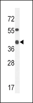 ADH4 Antibody (C-term)