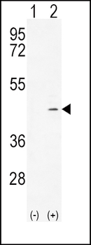 ADH4 Antibody (C-term)