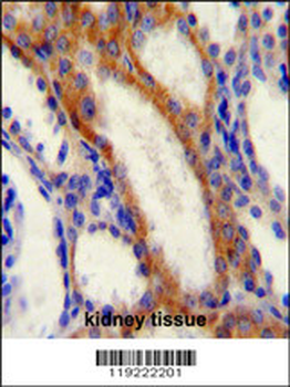 STIM1 Antibody (C-term)