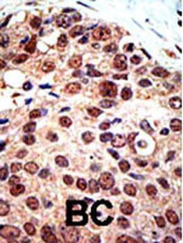 PRMT3 Antibody (C-term)
