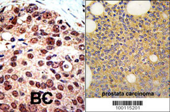 PRMT3 Antibody (C-term)