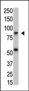 IKK beta Antibody