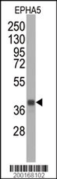 EPHA5 Antibody