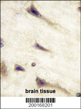 EPHA5 Antibody