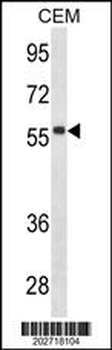 IGHD Antibody (N-term)