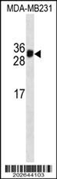 HKLK3 Antibody (C234)