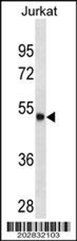 ARSA Antibody (C-term)