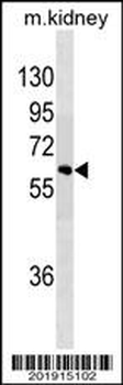 SPRED1 Antibody
