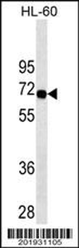 SWAP70 Antibody