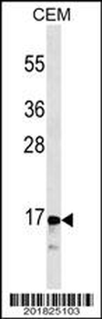 CALCA/CT Antibody