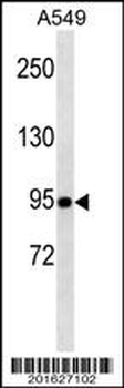 TLE1 Antibody (Center)