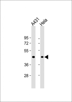 ACTA1 Antibody