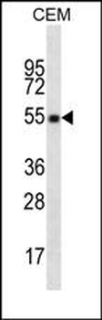 CD4 Antibody
